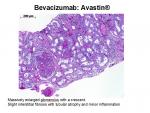 img-bevacizumab-0011.jpg