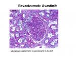 img-bevacizumab-0012.jpg