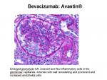 img-bevacizumab-0013.jpg