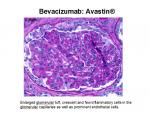 img-bevacizumab-0014.jpg