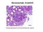 img-bevacizumab-0015.jpg