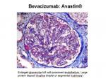 img-bevacizumab-0016.jpg