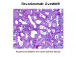 img-bevacizumab-0017.jpg