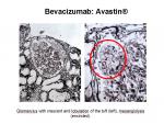 img-bevacizumab-0018.jpg