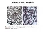 img-bevacizumab-0019.jpg