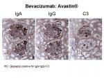 img-bevacizumab-0020.jpg