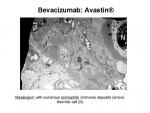 img-bevacizumab-0023.jpg