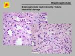 img-Bisphosphonates-0005.jpg