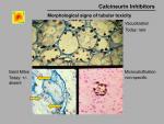 img-Calcineurin inhibitors-0013.jpg