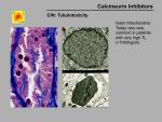 img-Calcineurin inhibitors-0014.jpg