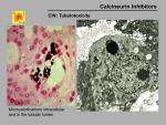 img-Calcineurin inhibitors-0015.jpg