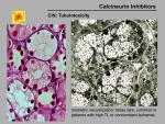 img-Calcineurin inhibitors-0016.jpg