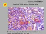 img-Calcineurin inhibitors-0020.jpg