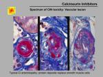 img-Calcineurin inhibitors-0021.jpg