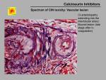 img-Calcineurin inhibitors-0022.jpg