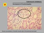 img-Calcineurin inhibitors-0026.jpg