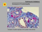 img-Calcineurin inhibitors-0028.jpg