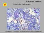 img-Calcineurin inhibitors-0031.jpg