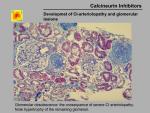 img-Calcineurin inhibitors-0032.jpg