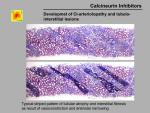 img-Calcineurin inhibitors-0033.jpg