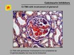 img-Calcineurin inhibitors-0035.jpg