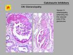 img-Calcineurin inhibitors-0036.jpg