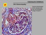 img-Calcineurin inhibitors-0037.jpg