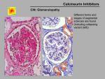 img-Calcineurin inhibitors-0038.jpg