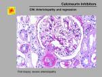 img-Calcineurin inhibitors-0040.jpg