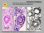 img-Calcineurin inhibitors-0041.jpg