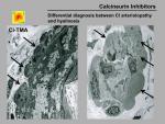 img-Calcineurin inhibitors-0045.jpg