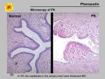 img-phenacetin-0005.jpg