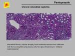 img-Proton pump inhibitors-0005.jpg