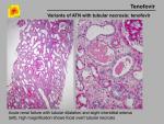 img-Tenofovir-0003.jpg