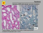 img-Tenofovir-0004.jpg