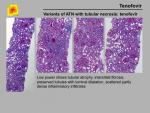 img-Tenofovir-0005.jpg