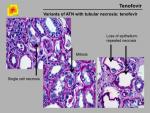 img-Tenofovir-0007.jpg