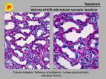 img-Tenofovir-0008.jpg