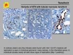 img-Tenofovir-0009.jpg