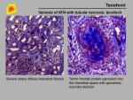 img-Tenofovir-0010.jpg